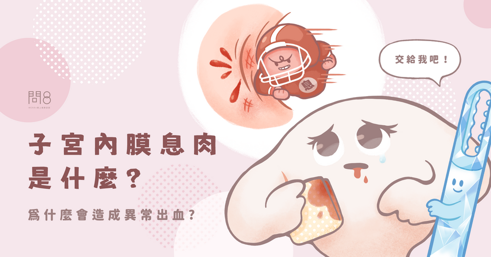 子宮內膜息肉是什麼?為什麼會造成異常出血