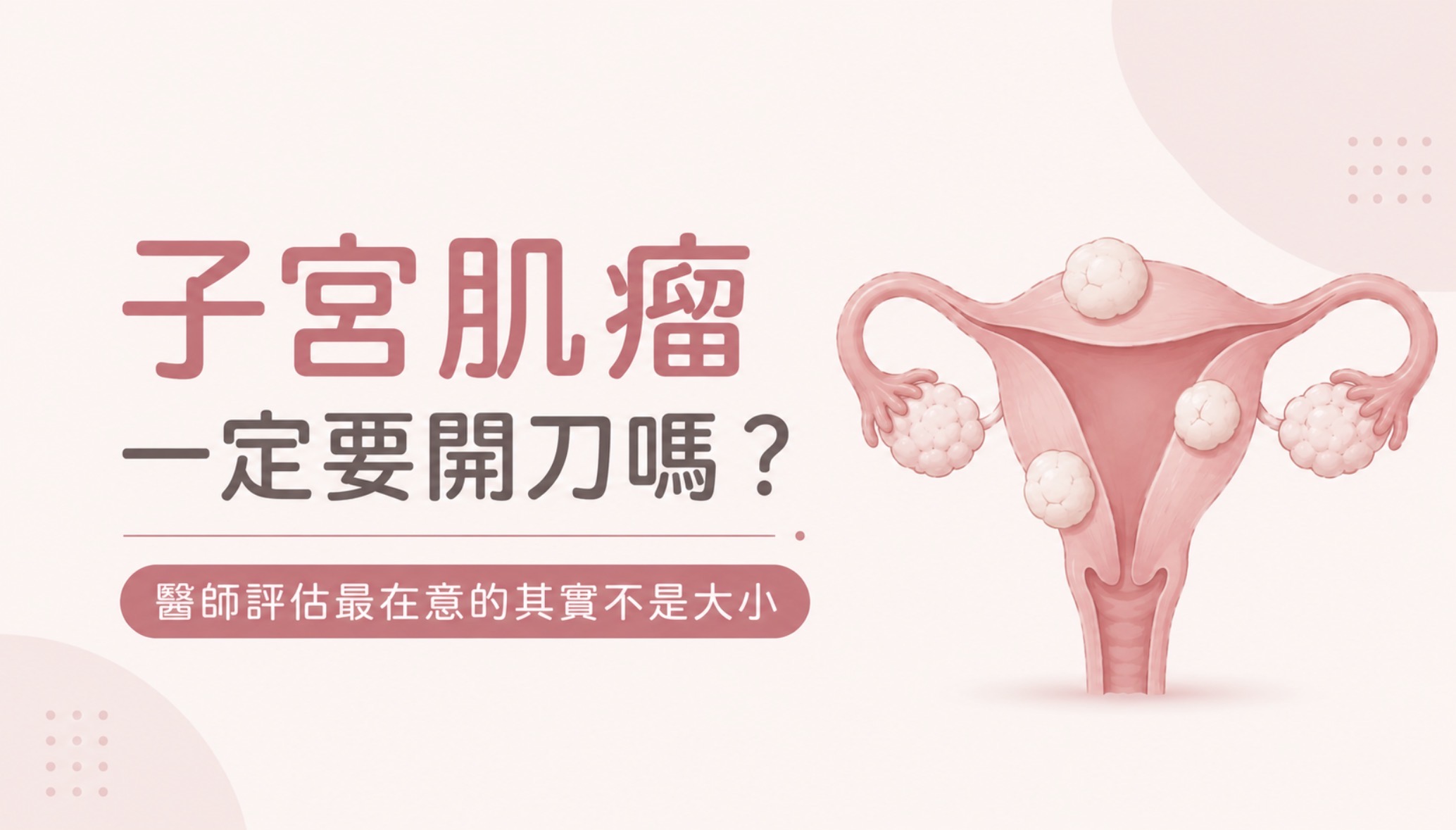 子宮肌瘤一定要開刀嗎?醫師評估最在意的其實不是大小