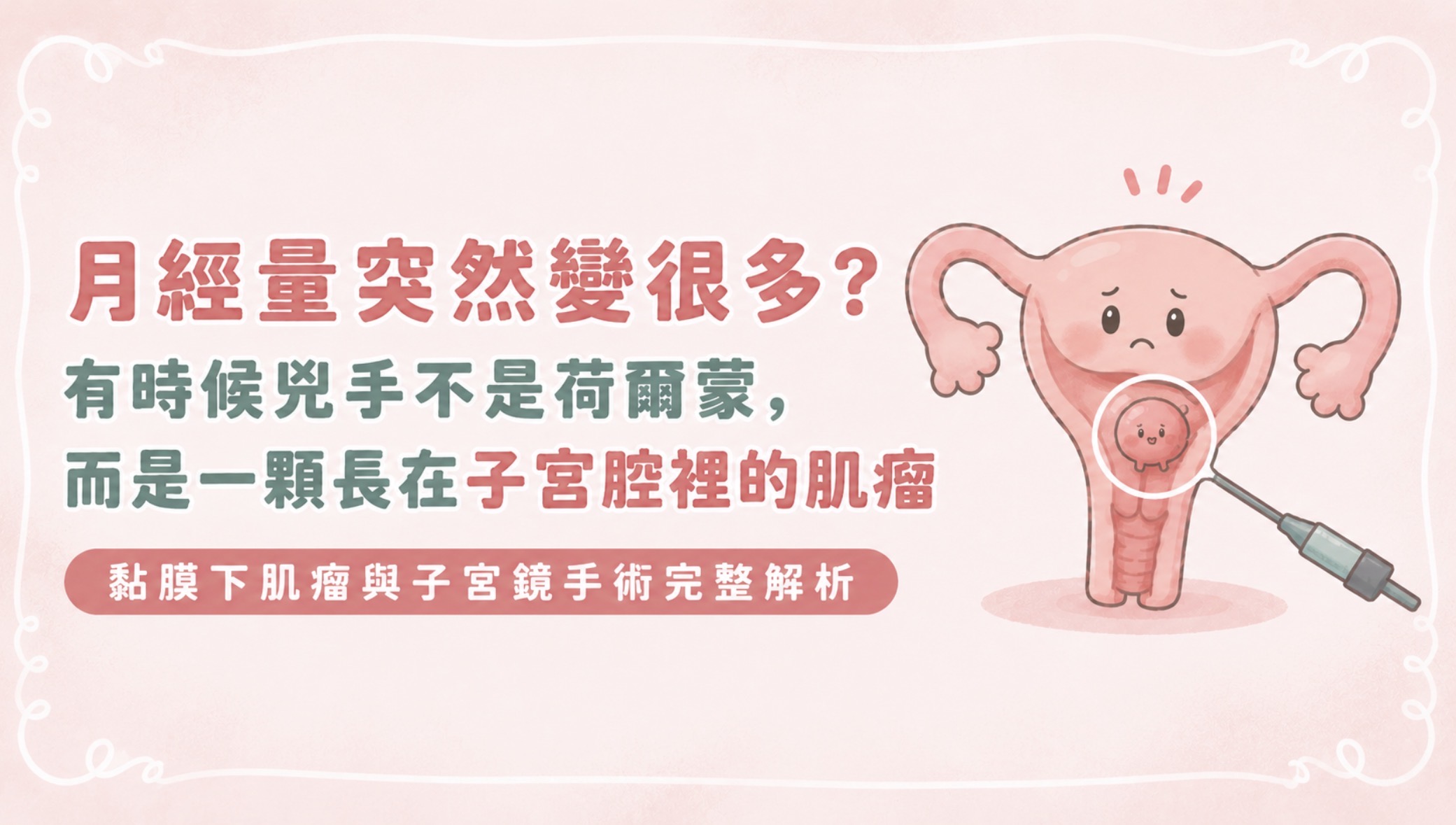 月經量突然變很多?有時候兇手不是荷爾蒙,而是一顆長在子宮腔裡的肌瘤