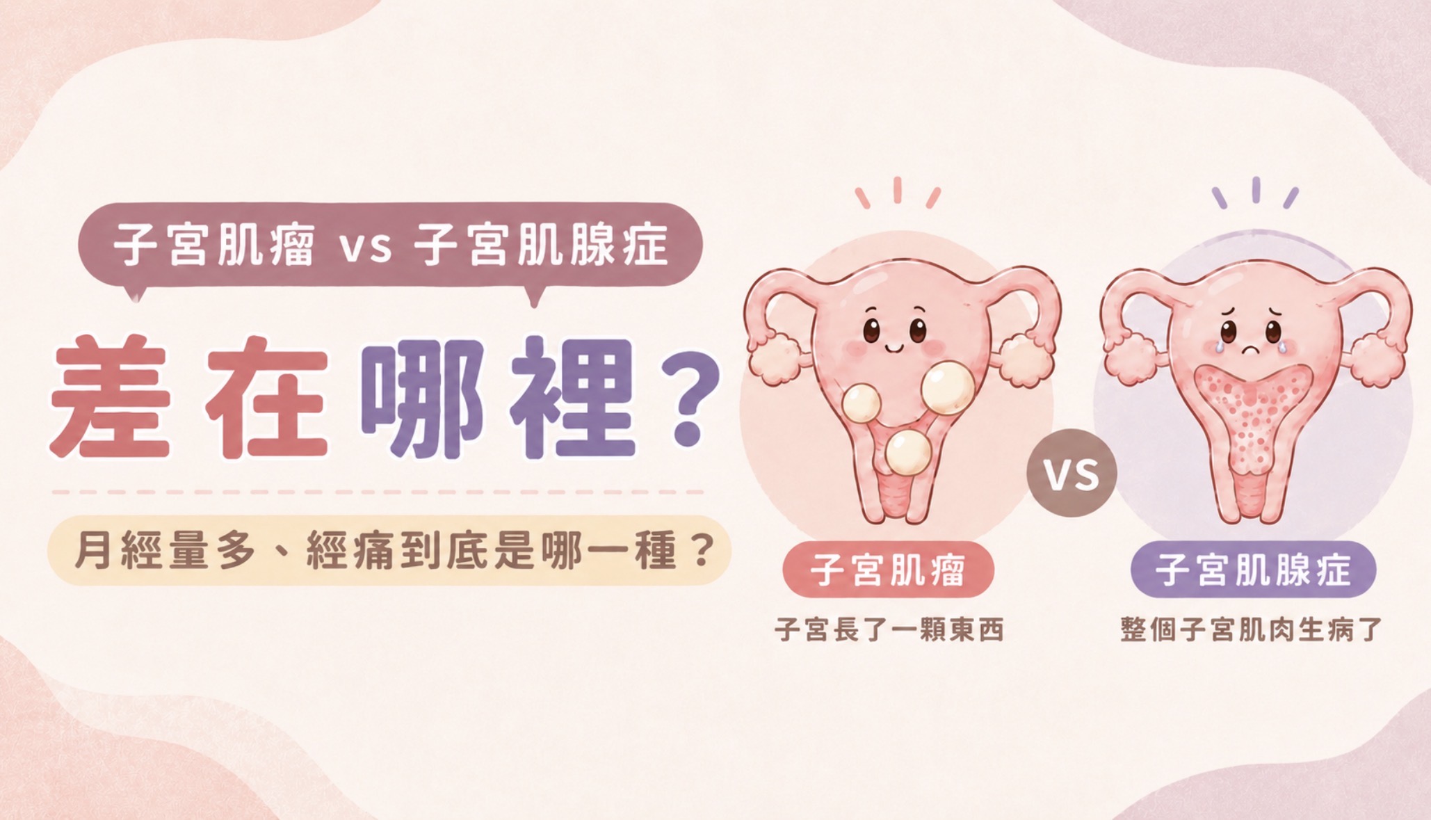 子宮肌瘤和子宮肌腺症差在哪?月經量多、經痛到底是哪一種?