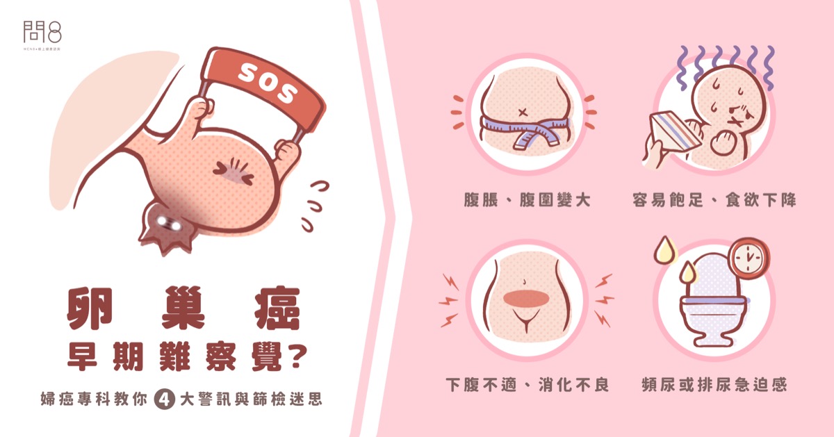 卵巢癌早期難察覺?婦癌專科教你4大警訊與篩檢迷思