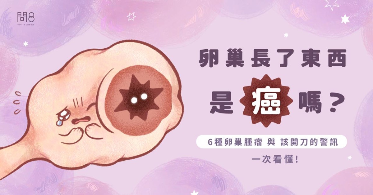 卵巢長了東西是癌嗎?6種卵巢腫瘤與「該開刀」的警訊