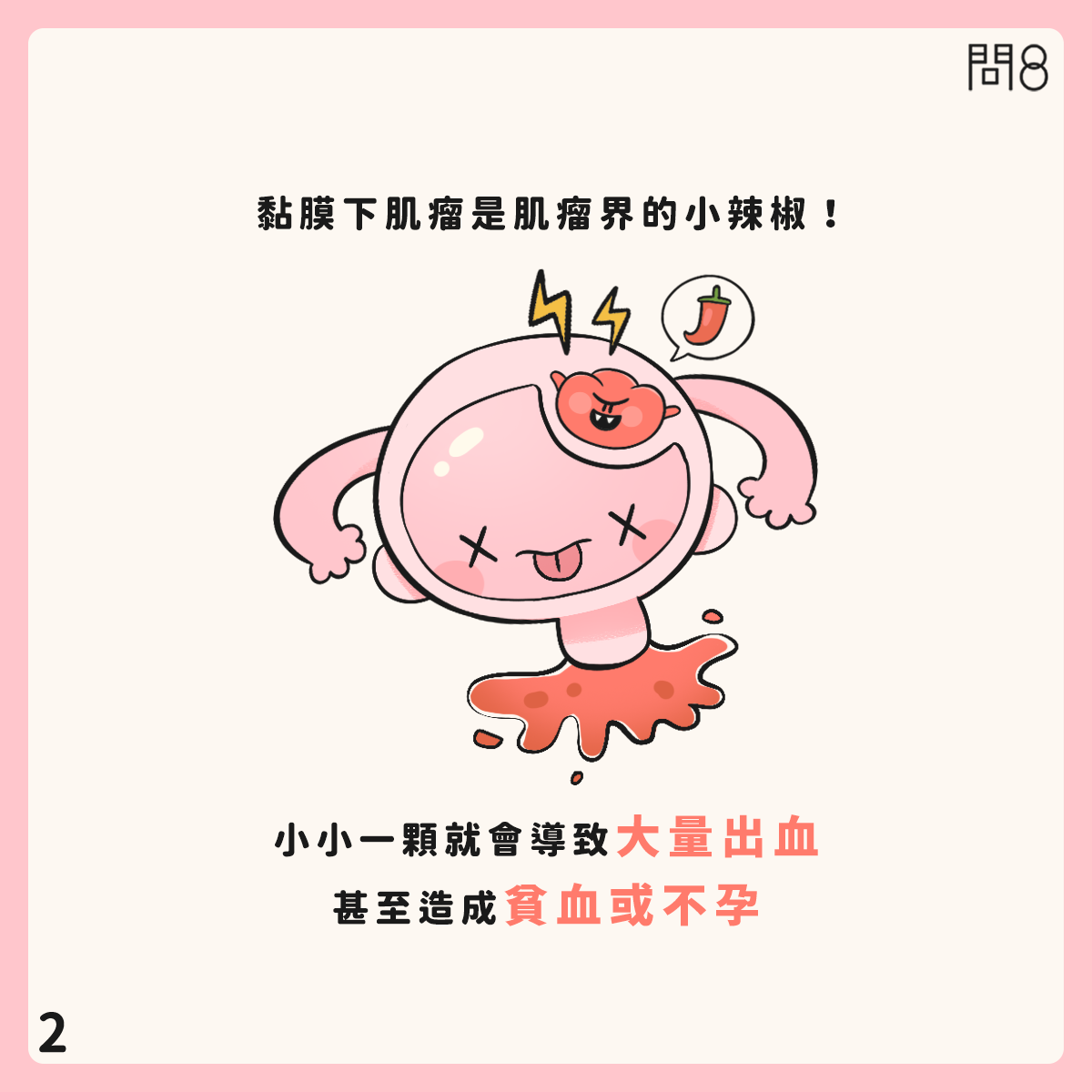 粘膜下肌瘤的治療原則—多波光雷射、電燒、冷刀如何選擇?