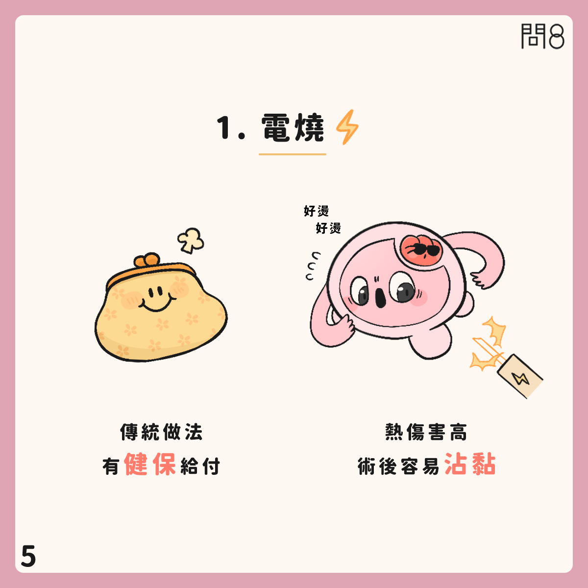粘膜下肌瘤的治療原則—多波光雷射、電燒、冷刀如何選擇?
